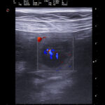00047545_00098732_DICOM_US_2025_07_11_0000836752